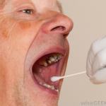 Buccal swab sampling. Source: WiseGeek.com